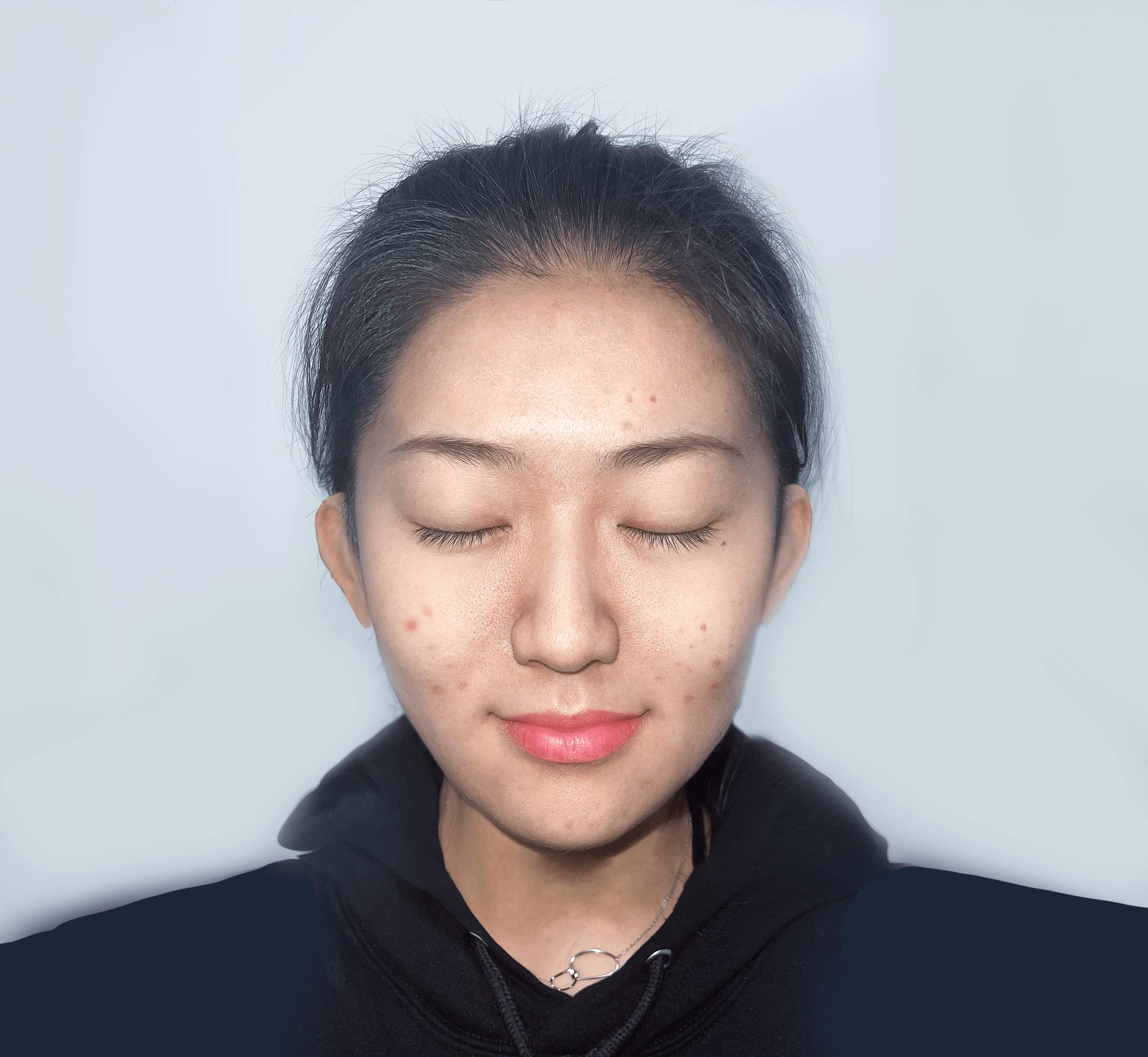 Skin analysis in progress